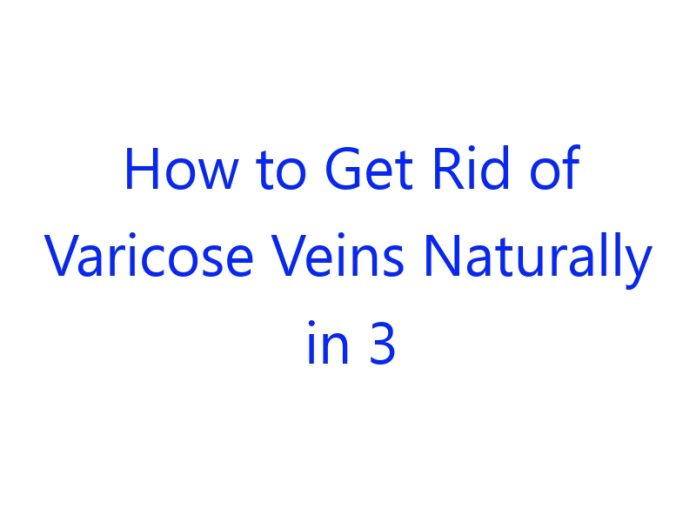 How to Get Rid of Varicose Veins Naturally in 3 Minutes